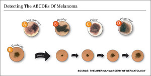 6-melanoma
