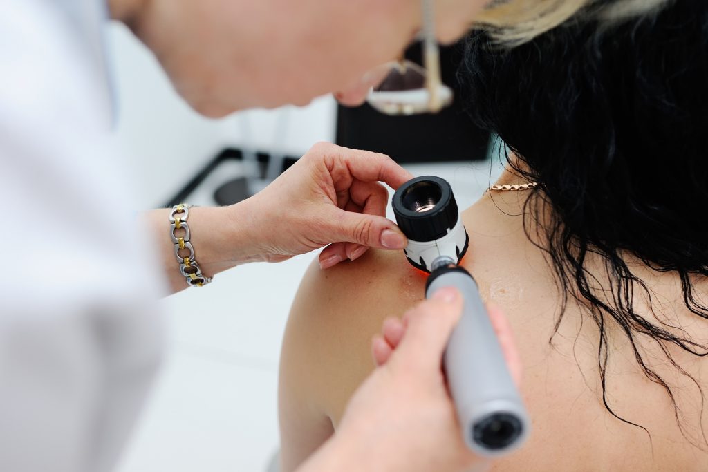 Dermatologia clínica: como proceder quando verificamos o surgimento de verrugas